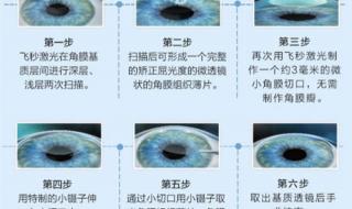 植入晶体多少钱 植入晶体多少钱