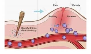 吞刀片怎么缓解疼痛